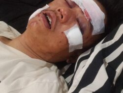 Didugan Polsek Kikim Timur Abaikan Laporan Masyarat, Kasus Penganiayaan Berat